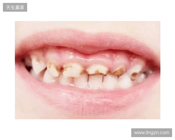 韦林顿确诊上唇部贯通伤；11、21牙半脱位；上颌前牙区牙槽骨骨折