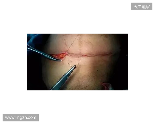 广州豹官方：杨浩眉弓伤口缝合30余针，预计5-7天后拆线